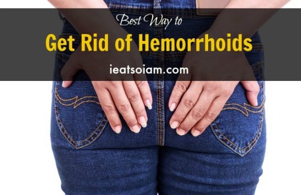Best Way to Get Rid of Hemorrhoids